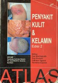ATLAS Penyakit Kulit dan Kelamin : Edisi Kedua